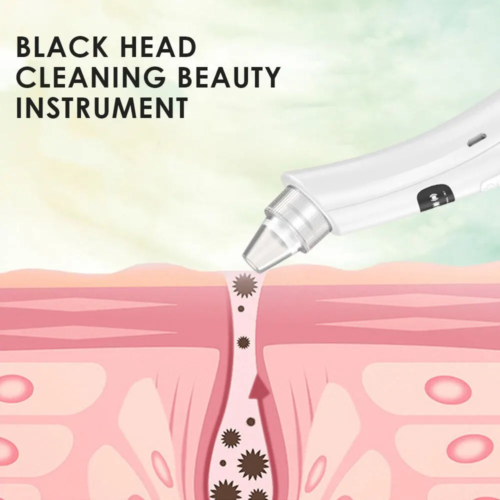 Blackhead Vacuum Pore Cleanser