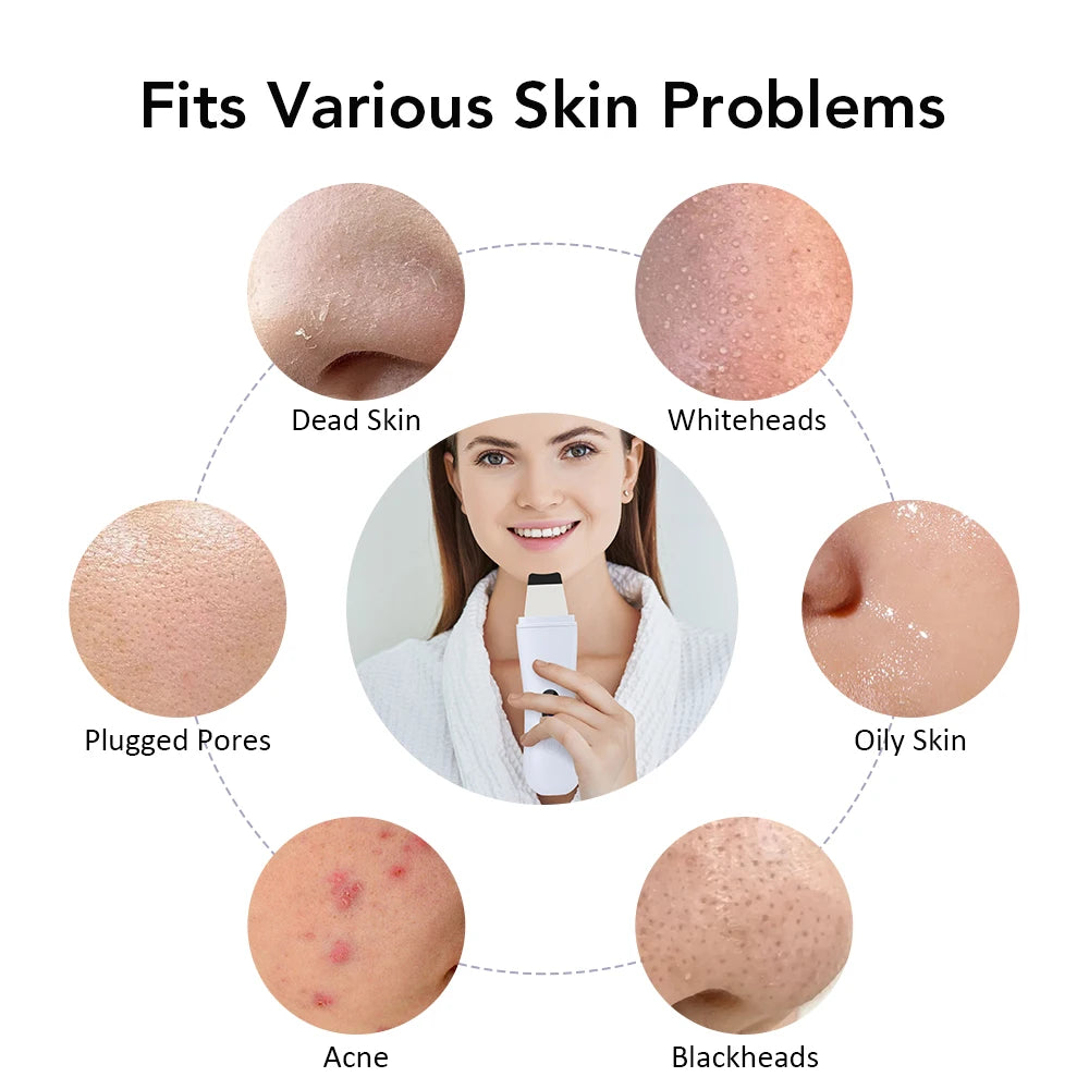 Ultrasonic Skin Spatula & Face Lift