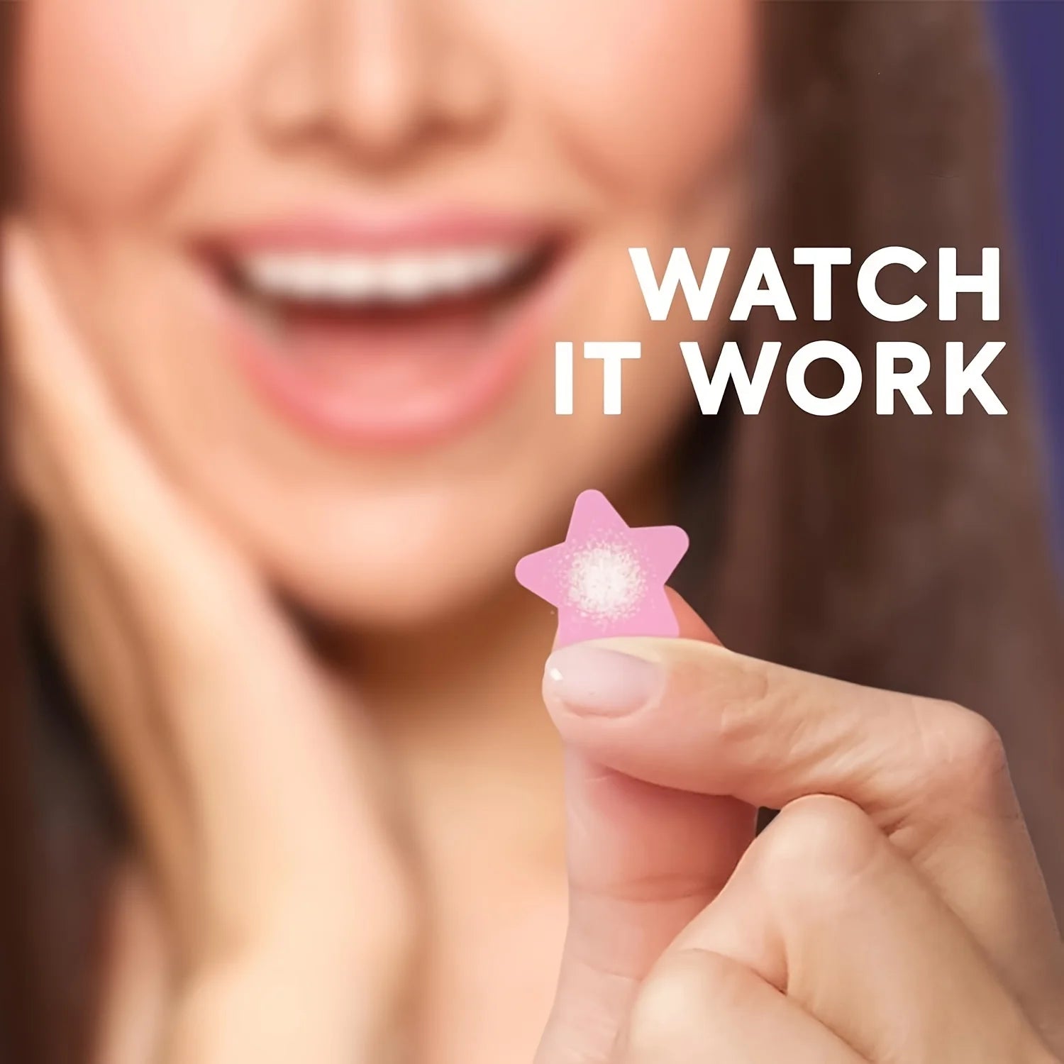 Star Pimple Patches 432 Pack