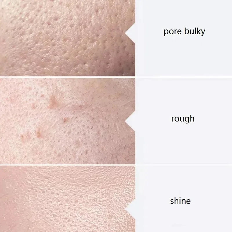 Aqua Peel Face Serum Kit — 400ml
