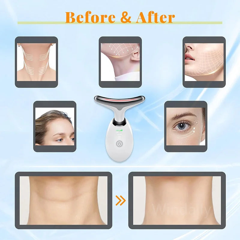 7-Colour LED Face & Neck Lifter